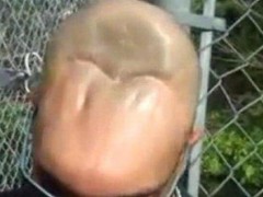 (半脑哥活了多久)现在像正常人一样活着半个脑袋被医生切除